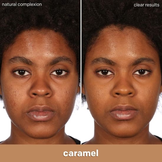 ALMAY Clear Complexion Foundation CARAMEL 800 salicylic acid acne treatment - Health & Beauty:Makeup:Face:Foundation