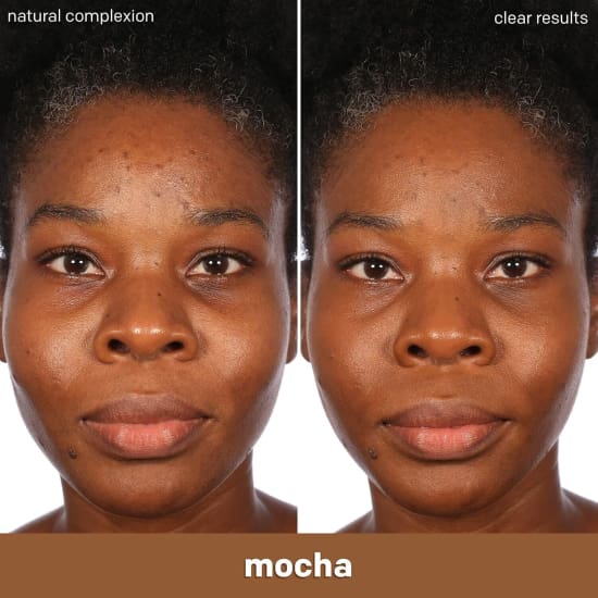 ALMAY Clear Complexion Foundation MOCHA 910 30mL salicylic acid acne treatment - Health & Beauty:Makeup:Face:Foundation